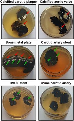 EMbedding and Backscattered Scanning Electron Microscopy: A Detailed Protocol for the Whole-Specimen, High-Resolution Analysis of Cardiovascular Tissues